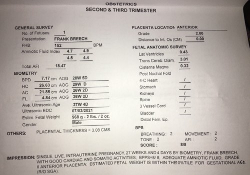Small for Gestational Age