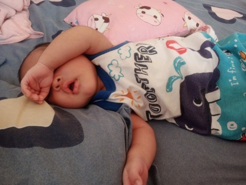 Punggung baby MELECET .. macam mane nak rawatnya ??
