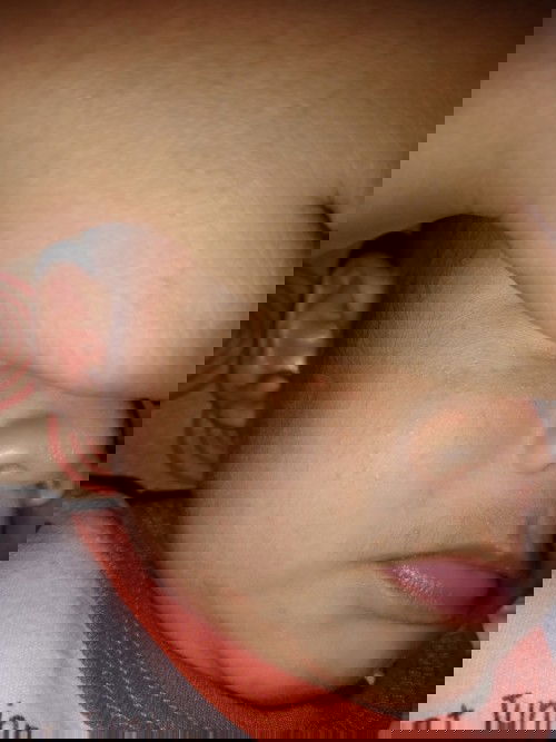 Cara hilangin bruntusan