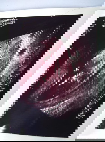 Bunda ada yg tau ini detak jantung ny normal apa nggak ya kira2 berapa detak jantung saya g ngerti..