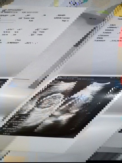 RS. Mitra keluarga kalideres (dr.William Timotius)