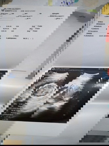 RS. Mitra keluarga kalideres (dr.William Timotius)