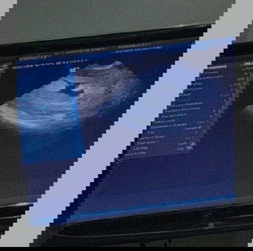 Please enlighten me. Possible Twins ba?