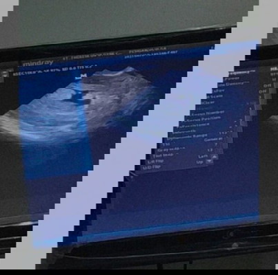 Please enlighten me. Possible Twins ba?