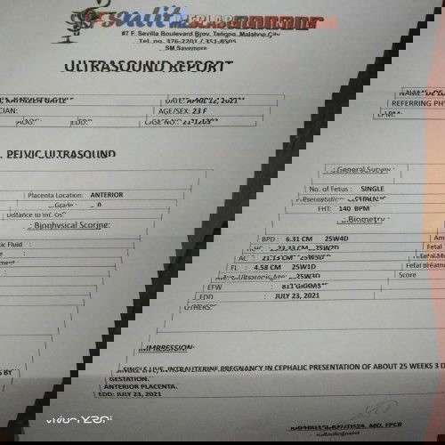 Pakisagot naman po mga momshie