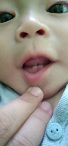 REKOMENDASI SUFOR UNTUK NAMBAH BOBOT ANAK