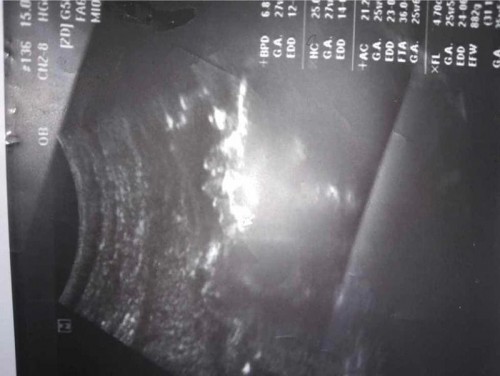 น้ำหนักขึ้นแค่สองโล