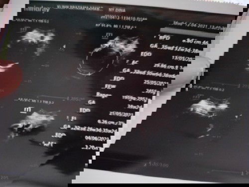 Cara naikikin BB Dede