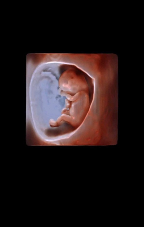 Bunda apakah ada yg sama usia kehamilan 12 wek, kepala sakit bgt, lemes, nafas sesak, dan rasa mual?