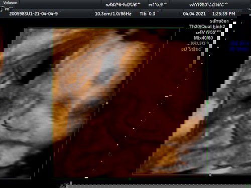 ❤️🧡💛💚💙💜🤍 ด.ญ. 29w แล้วค่ะ
