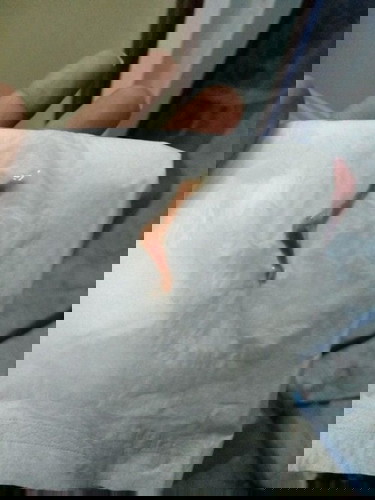 เเม่ๆท้อง ไม่อยากเเท้งควรรู้
#เล่าสู่กันฟัง