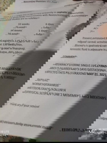 LMP: 36 weeks and 6 days now, 2.41kgs si baby subrang liit po ba nya?