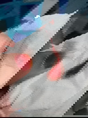 Assalamualaikum sye nk tanye nie darah campur coklat apa nie ye