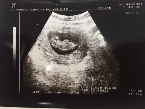 Hello Baby👶🏻❤️