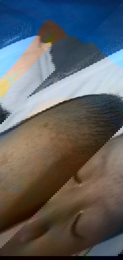 Kata nya si saraf nya nimbul