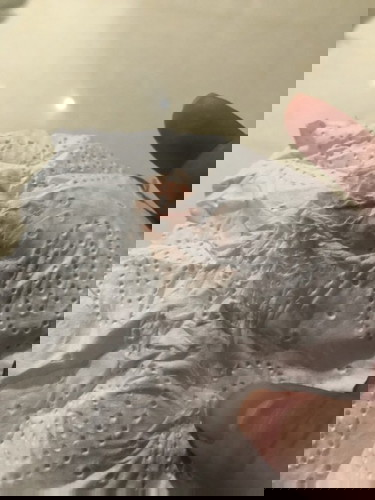 Brownish to bright red discharges