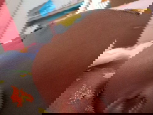 Warna putih d pipi seperti panu