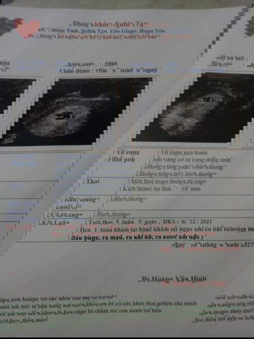 Mình đi siêu âm họ bảo là chưa có tim thai vìng nc ối k tròn với mầm thai kiếu bị tữa liệu có sao không ạ