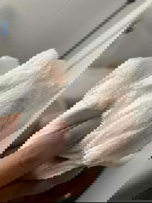 แบบนี้ต้องรีบไป รพ.ไหมค่ะ??