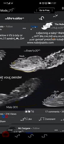 Baby Gender