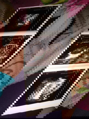Tingal nunggu
Mohon doa nya ya man teman