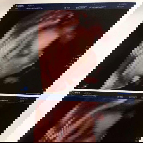 ซาวด์โฟดี ดูหน้าเบบี๋