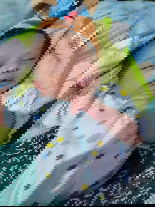 Bun, gimana ya mengatasi bapil pada bayi?