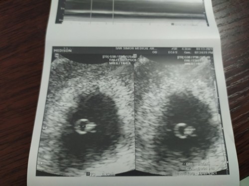 6 weeks instead of 7 weeks