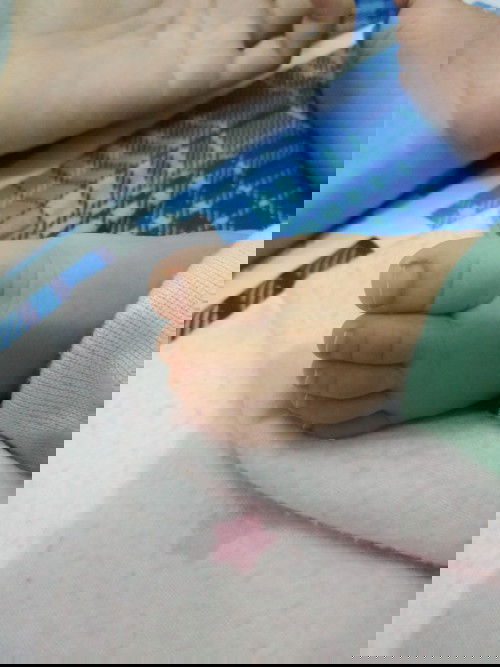 Kuku Cantengan pada Bayi