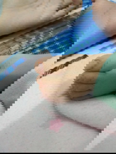 Kuku Cantengan pada Bayi