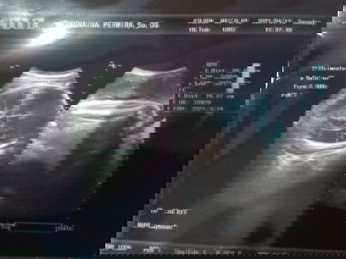 Terlewat hpl.d suruh terminasi