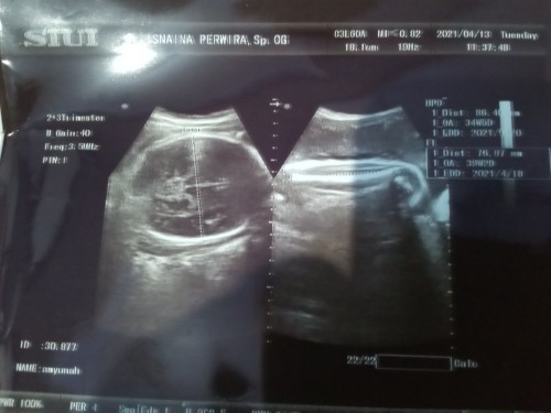 Terlewat hpl.d suruh terminasi