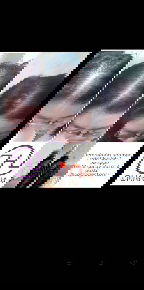 Shampo untuk rambut rontok