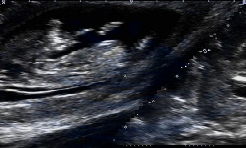 Guessing gender 🤔