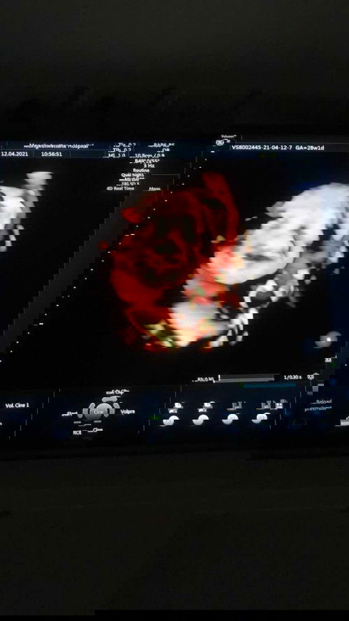 ออกมาจะเหมือนใครนะ