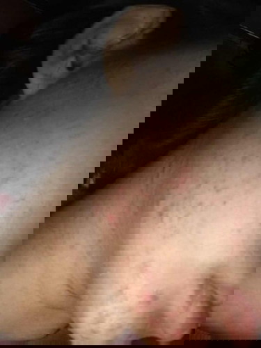 เเม่ๆคนไหนเป้นบ้างค่ะ