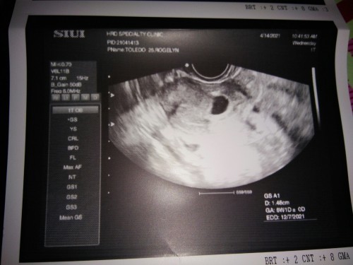 itatanong ko lang po