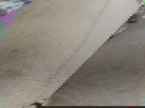 Gatal dan bintik-bintik ruam merah pada perut