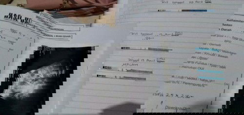 Bimbang sekali dengan ucapan orang lain bund