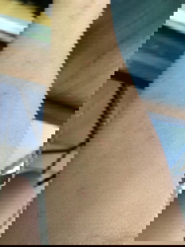 I’m 22 weeks preggy. I didn’t eat anything unusual.