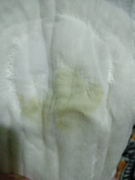 SETELAH MELAHIRKAN 2 BULAN