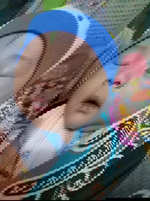 Jerawat putih kecil di muka bayi