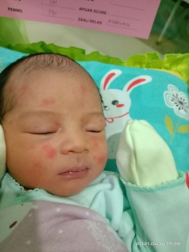 Gimana cara ngatasinnya yaah bun🥺?