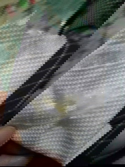 ตั้งครรภ์ 38+1 สัปดาห์