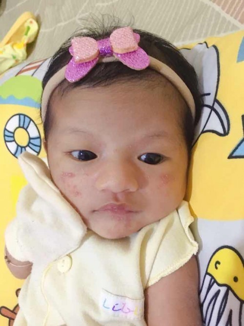Ruam ASI bayi