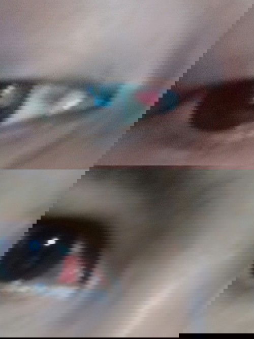 Bercak darah pada mata