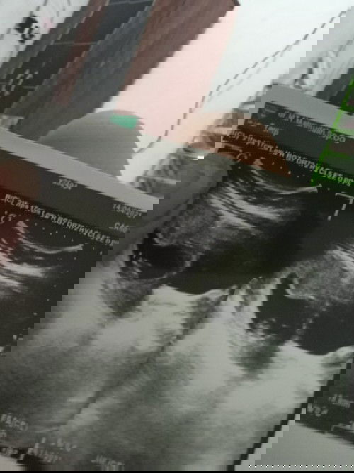 Hai bun aku habis usg