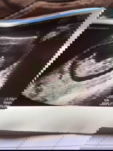 กำหนดคลอดเดือนตุลา แม่ๆจ๋า ช่วยทายกันเล่นๆได้มั้ยจ้ะ ว่าน้องจะเป็น ผญ. หรือ ผช. ❤️