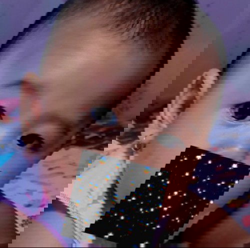 bun ada yang anaknya punya cacat mata kaya juling?