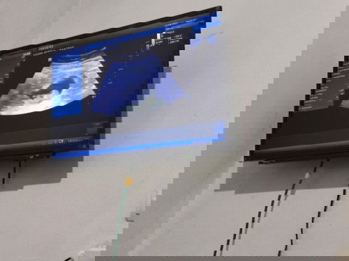 Bun...!!!  Mau tanya,apa tiap usg ke beda dokter hasil usg perkiraan umur kandungan beda ya !